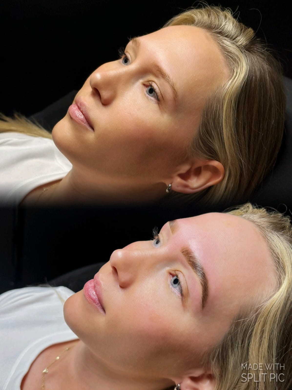 Before & After Brow Treatment